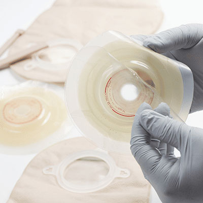 ostomy