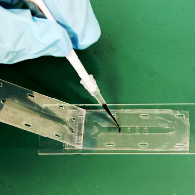 microfluidics_button_1